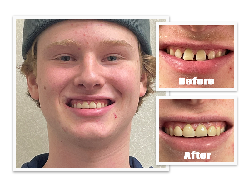 Before & After Transformation