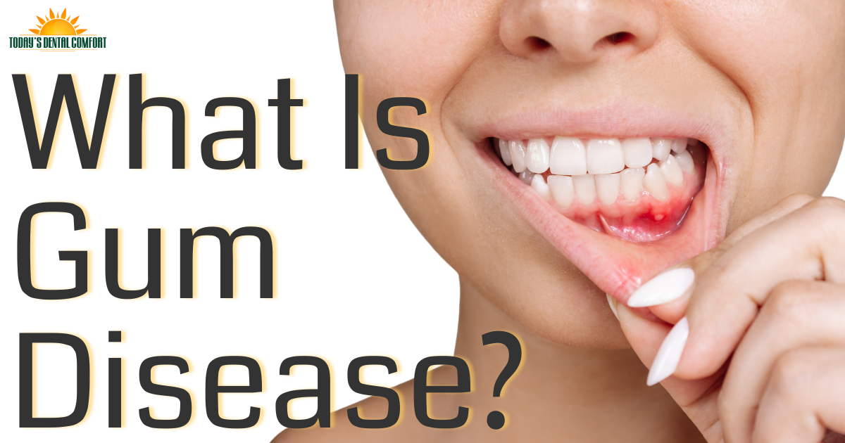 Bundy Blog June 2025